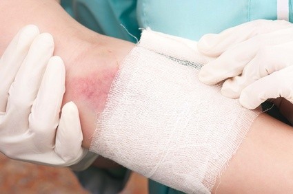 Uveljavljanje odškodnine iz naslova nezgodnega zavarovanja